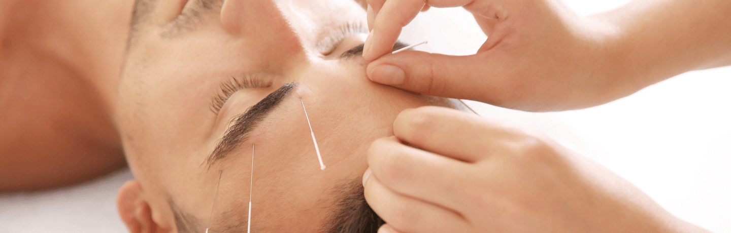 Die Geschichte der Augenakupunktur